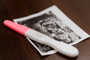Perda gestacional: como viver o luto e acolher a dor com apoio psicológico